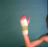 PREFERRED 1ST WRIST SUPPORT
